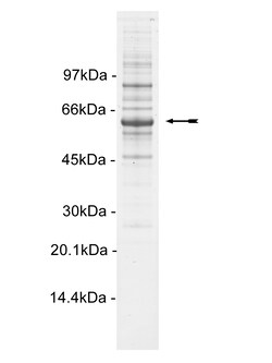 Eurofins DiscoverX ROK /ROCK-I Protein, Active 10 &mu;g | Buy Online | Eurofins DiscoverX | Fisher Scientific